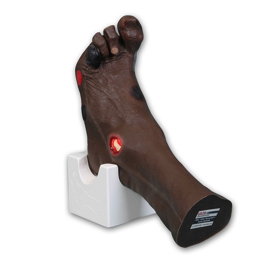 'Wilma' Wound Foot Model, Dark - GTSimulators.com - VATA