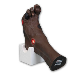 'Wilma' Wound Foot Model, Dark - GTSimulators.com - VATA